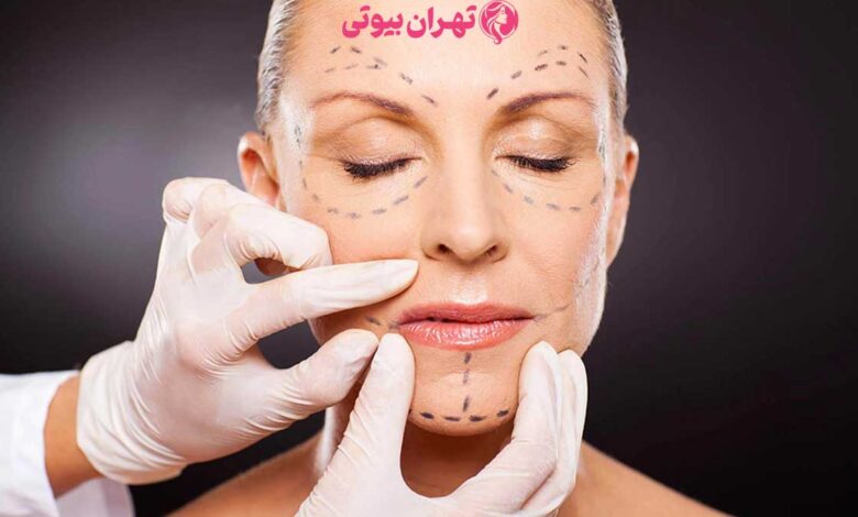 بهترین دکتر لیفت صورت در تهران