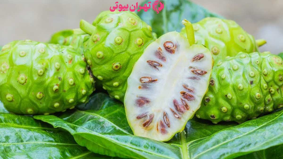 10 بهترین دکتر لابیاپلاستی در تهران
