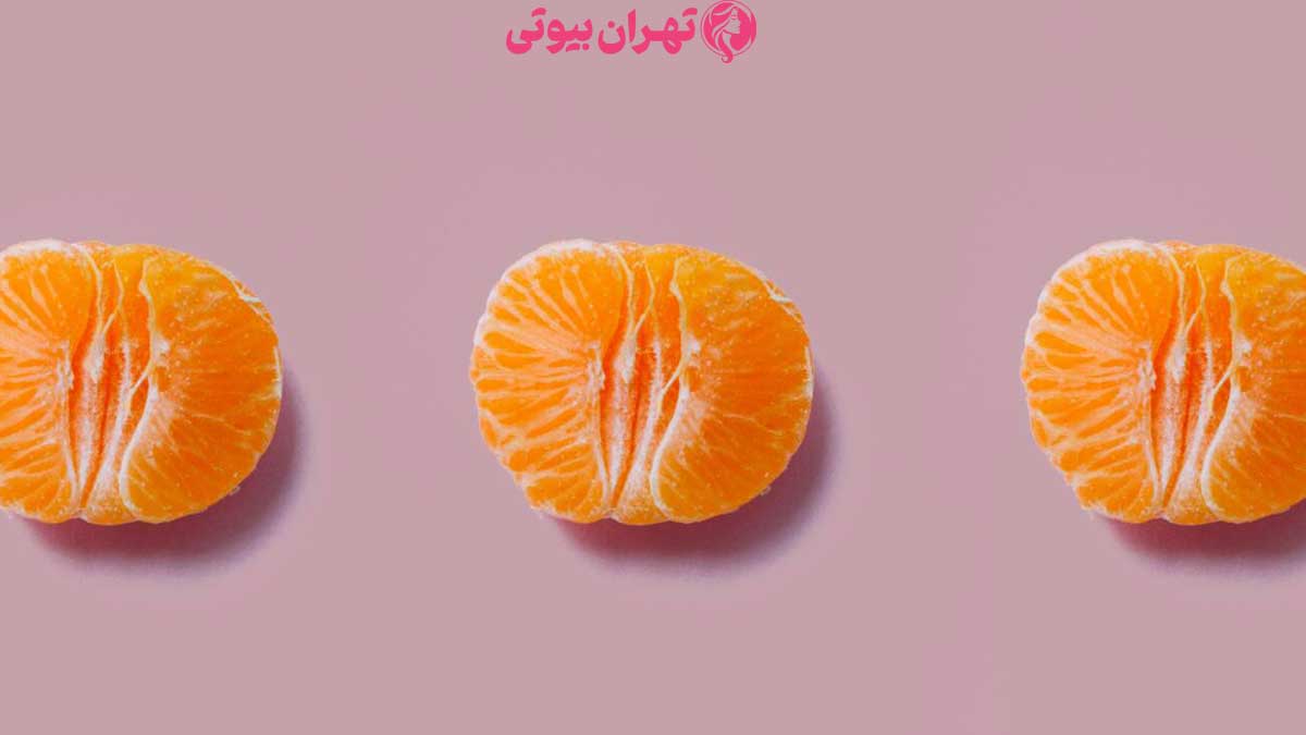 10 بهترین دکتر لابیاپلاستی در تهران