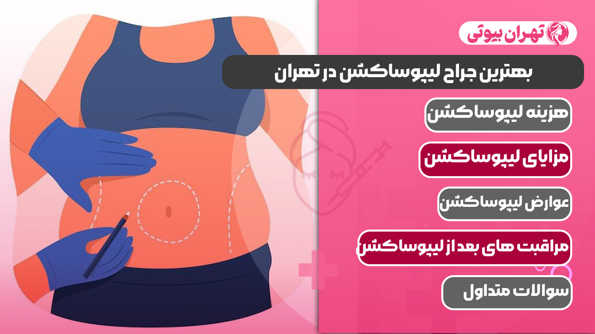 10 بهترین جراح لیپوساکشن در تهران