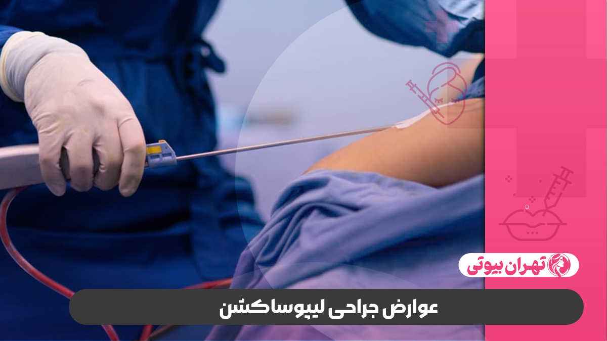 10 بهترین جراح لیپوساکشن در تهران