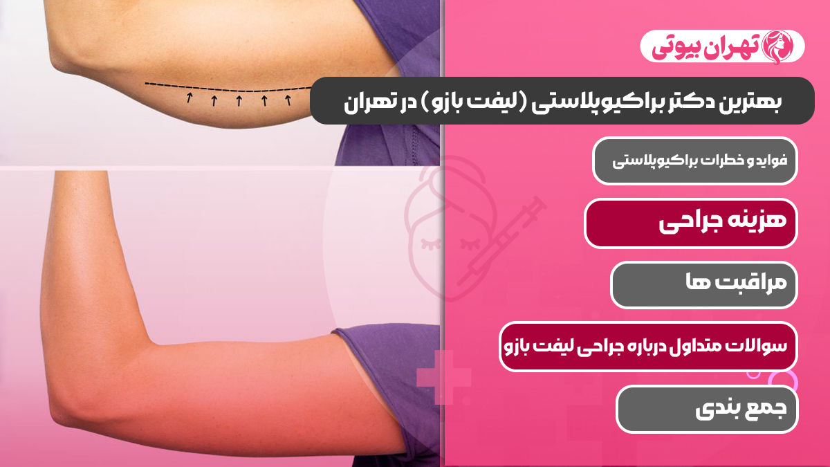 10 بهترین دکتر براکیوپلاستی (لیفت بازو) در تهران