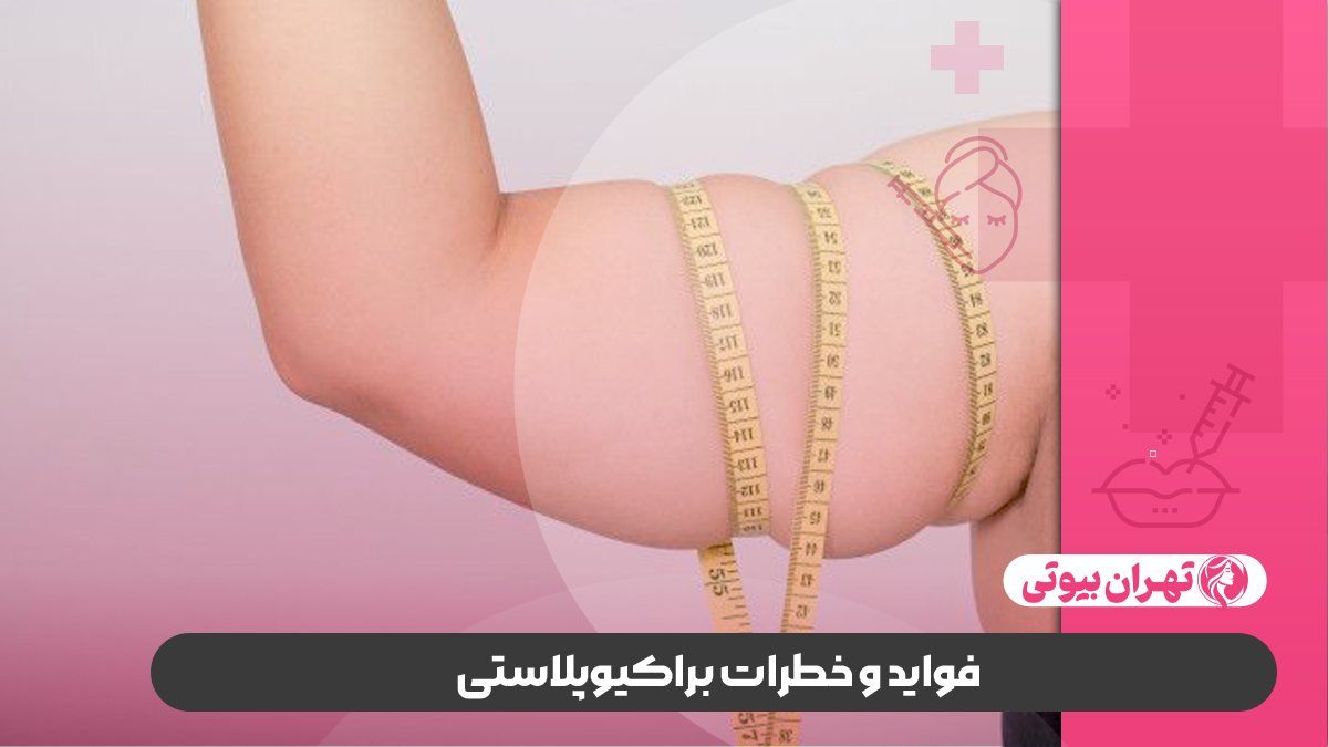 10 بهترین دکتر براکیوپلاستی (لیفت بازو) در تهران
