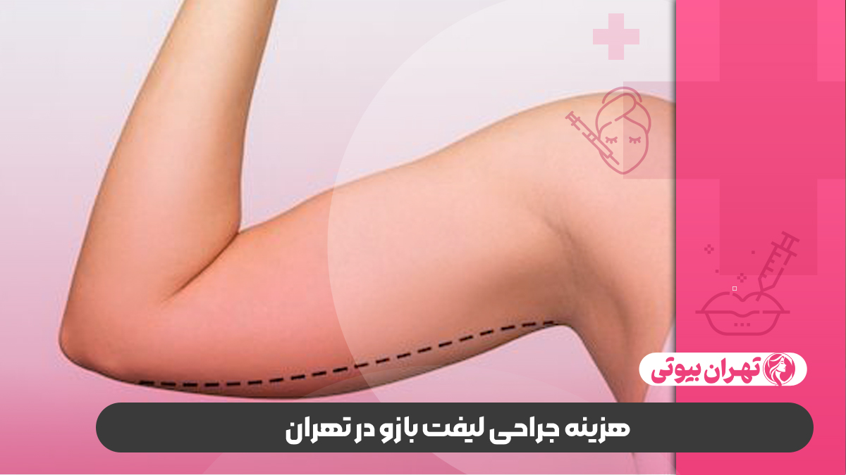 10 بهترین دکتر براکیوپلاستی (لیفت بازو) در تهران