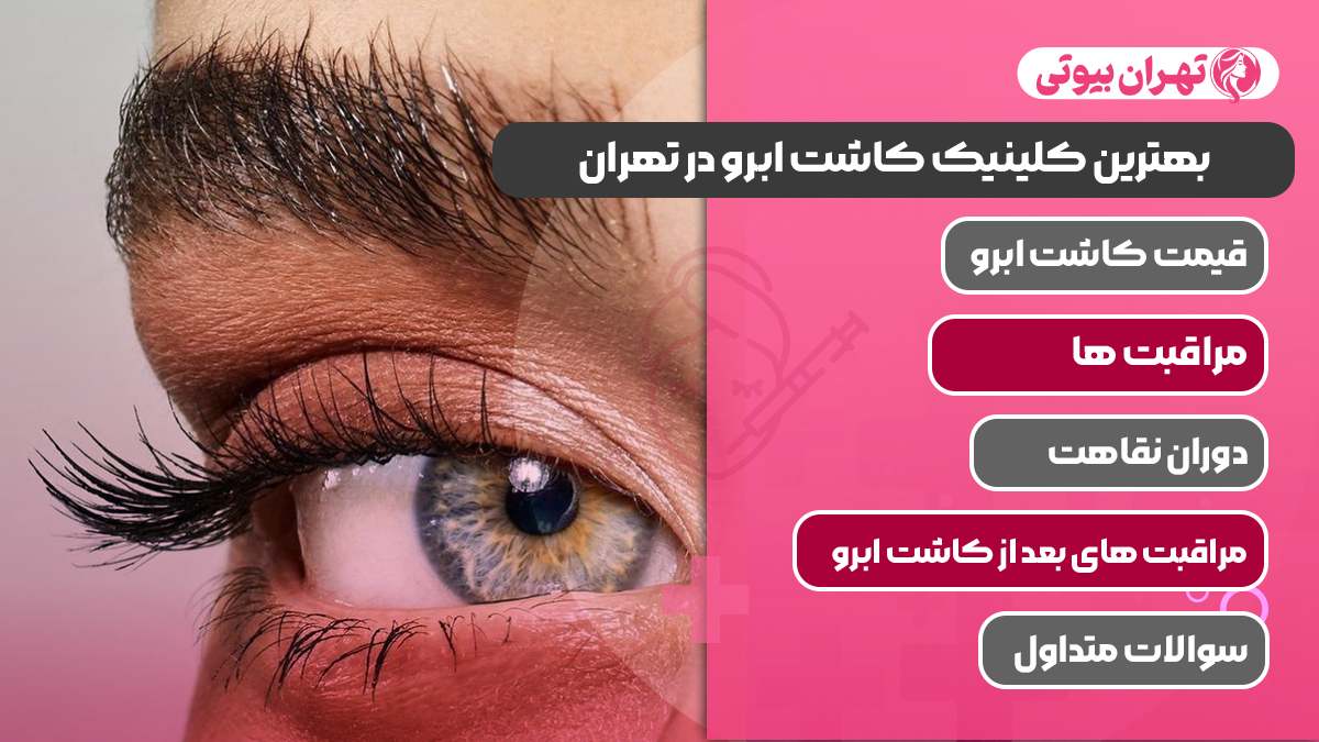 10 بهترین کلینیک کاشت ابرو در تهران