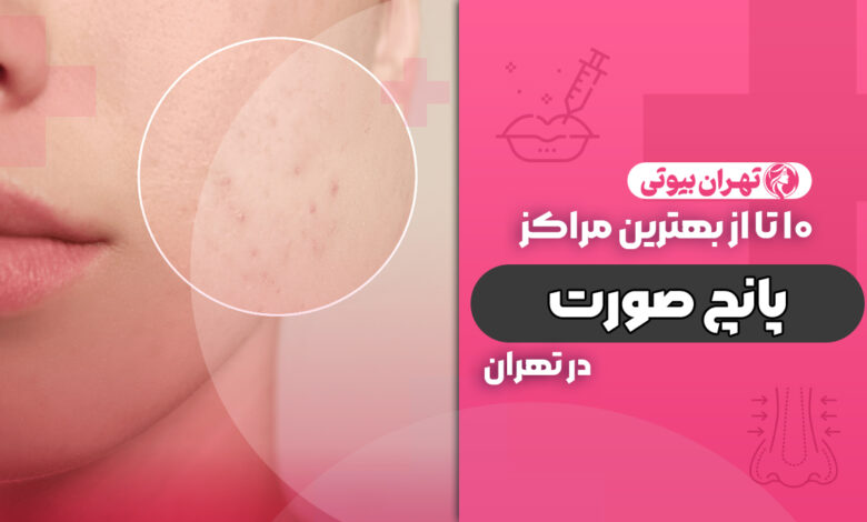10 بهترین مرکز پانچ صورت در تهران
