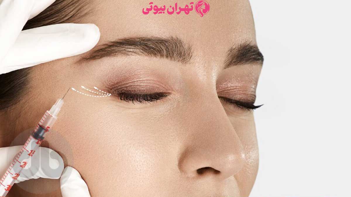 10 بهترین دکتر مزوتراپی صورت در تهران