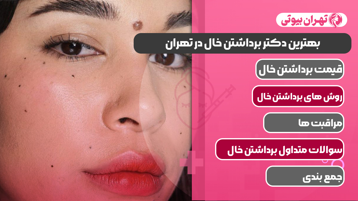 10 بهترین دکتر برداشتن خال در تهران