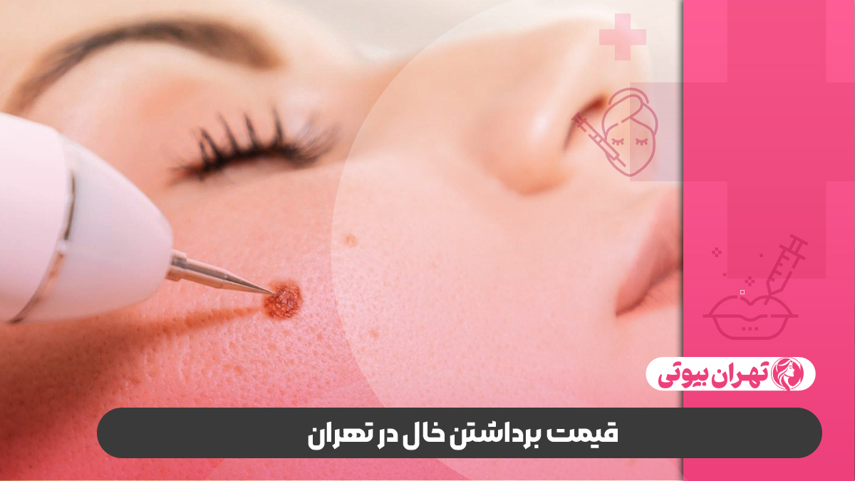 10 بهترین دکتر برداشتن خال در تهران