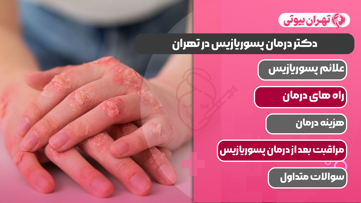 10 بهترین دکتر درمان پسوریازیس در تهران
