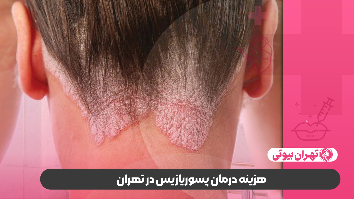 10 بهترین دکتر درمان پسوریازیس در تهران