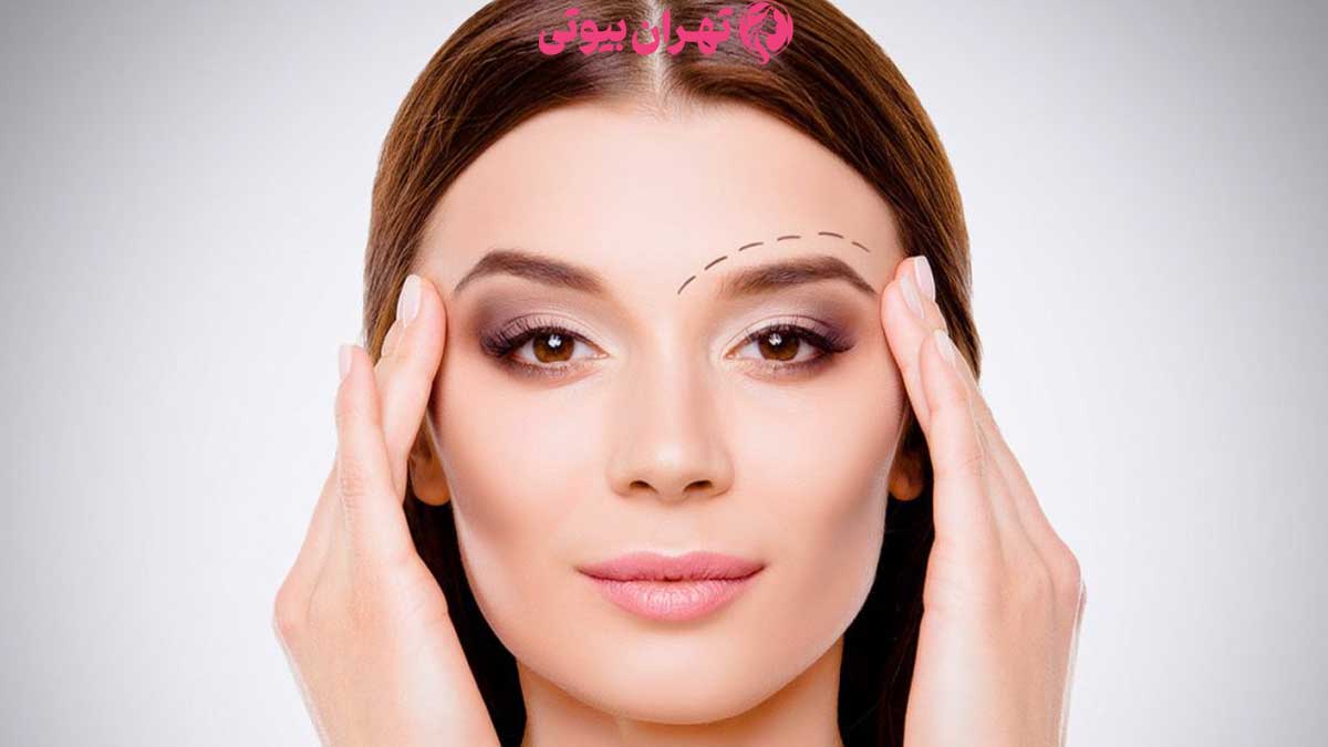10 بهترین دکتر لیفت شقیقه در تهران