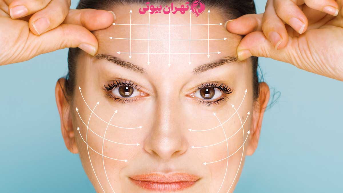 10 بهترین دکتر لیفت شقیقه در تهران
