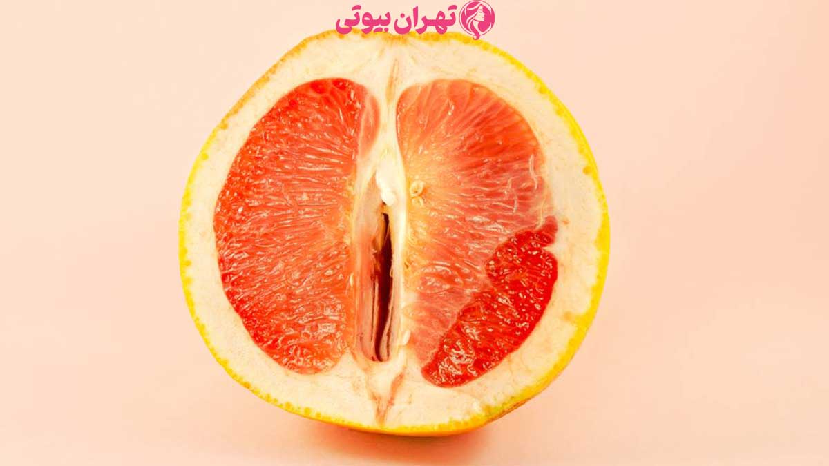 10 بهترین دکتر سفید کردن واژن در تهران