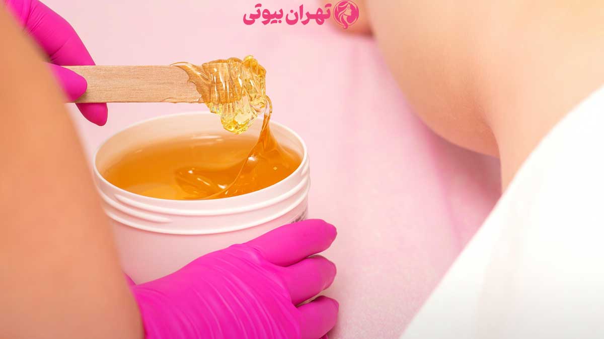 10 بهترین مرکز اپیلاسیون در تهران
