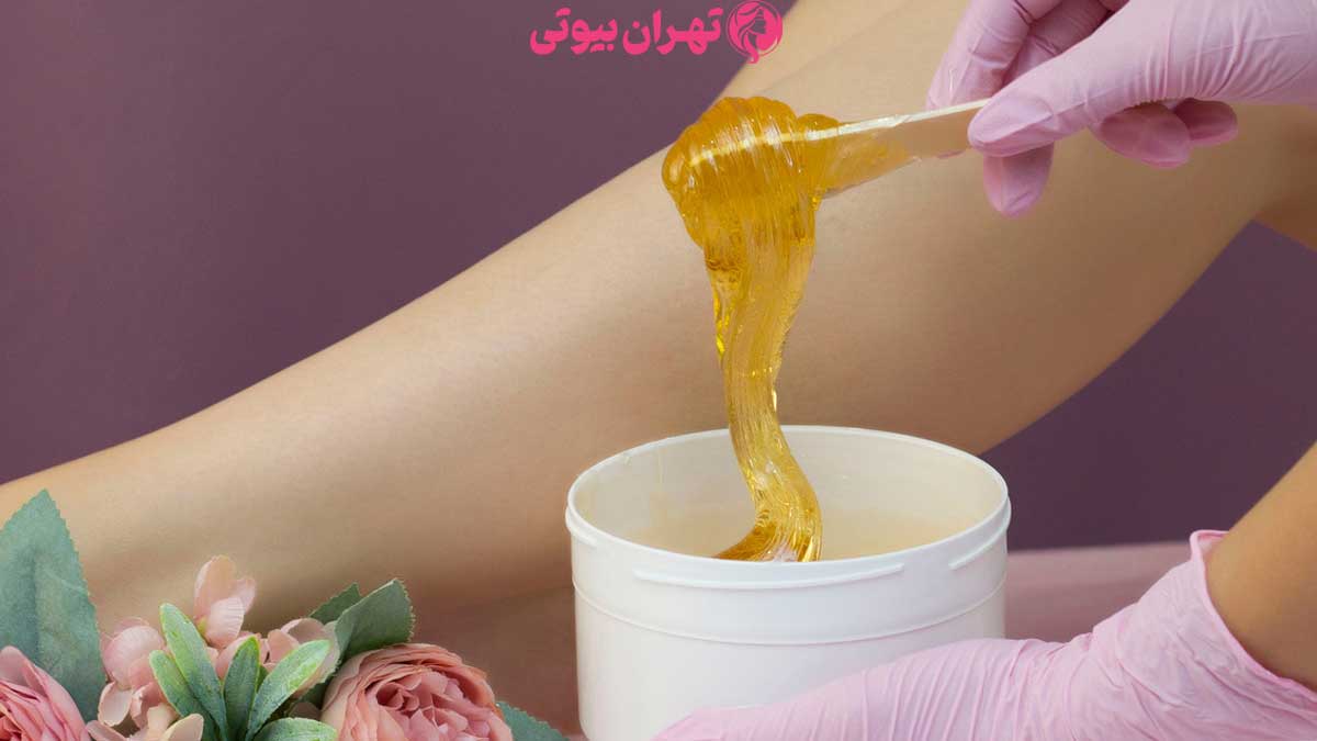 10 بهترین مرکز اپیلاسیون در تهران