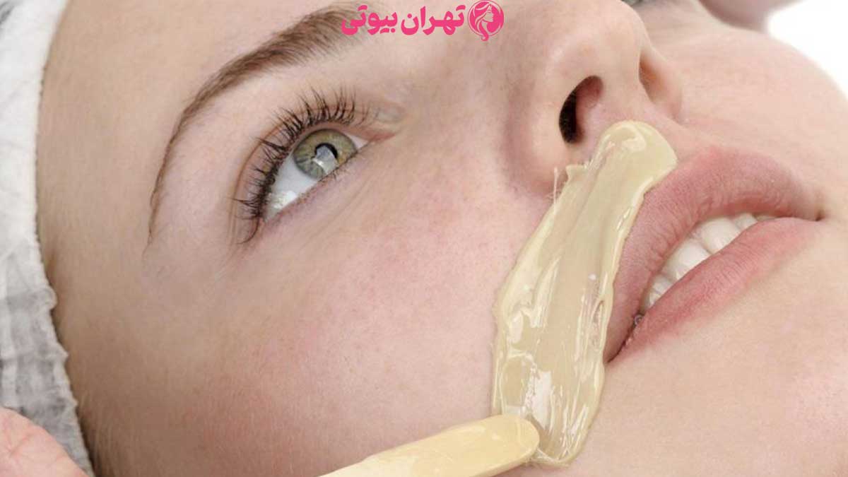 10 بهترین مرکز اپیلاسیون در تهران