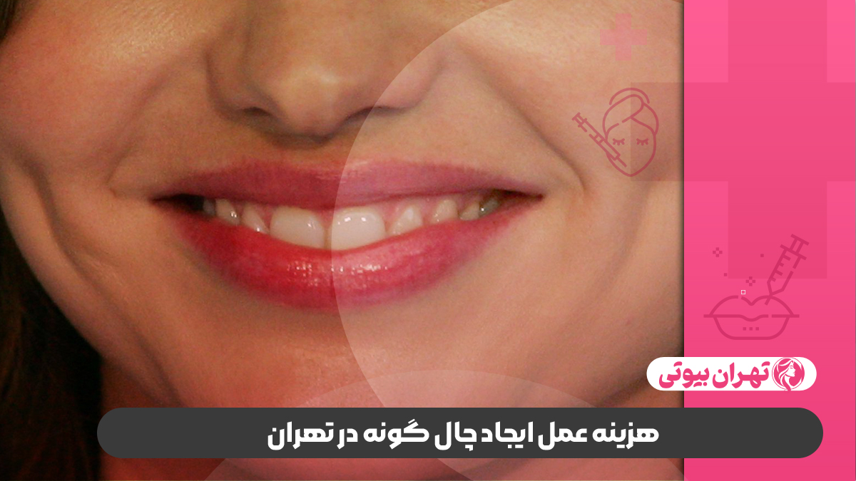 10 بهترین دکتر چال گونه در تهران
