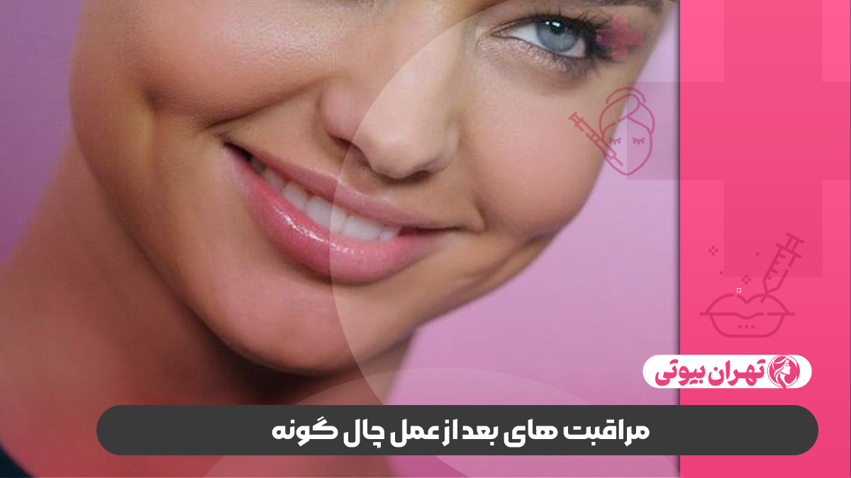 10 بهترین دکتر چال گونه در تهران