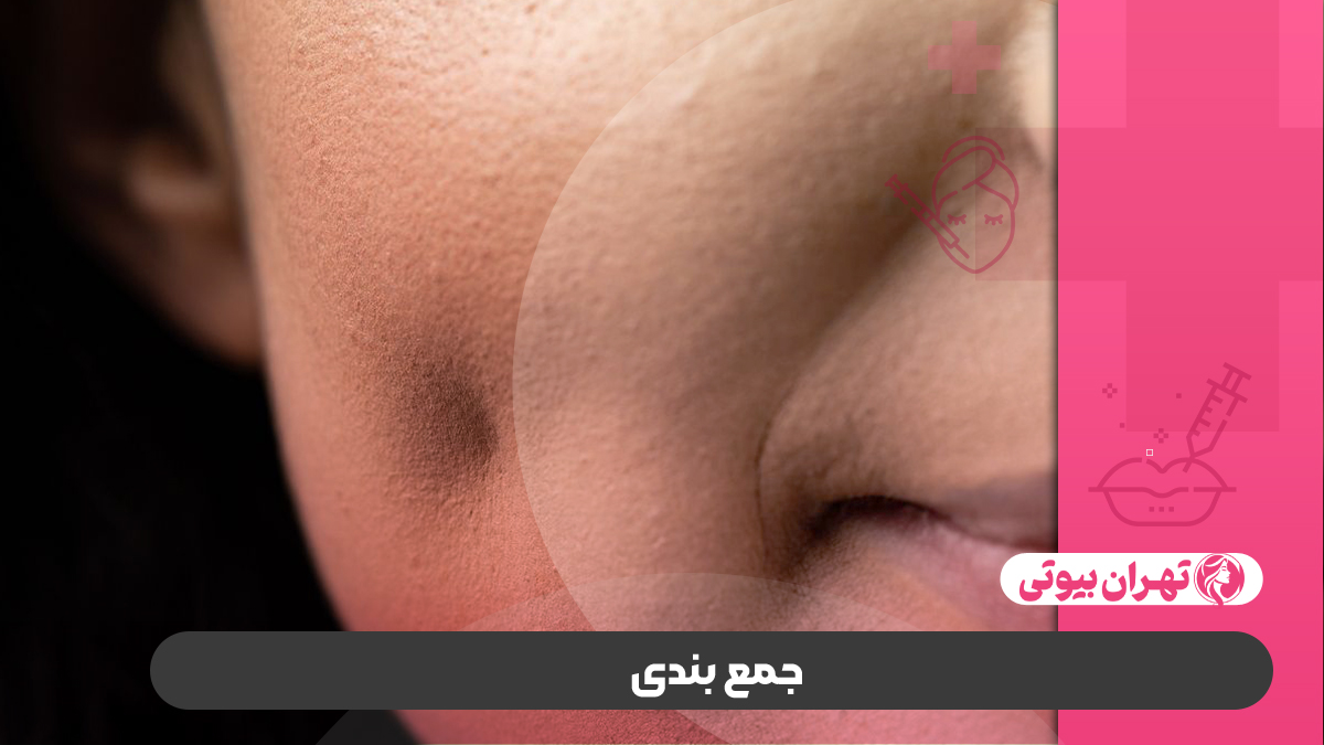 10 بهترین دکتر چال گونه در تهران