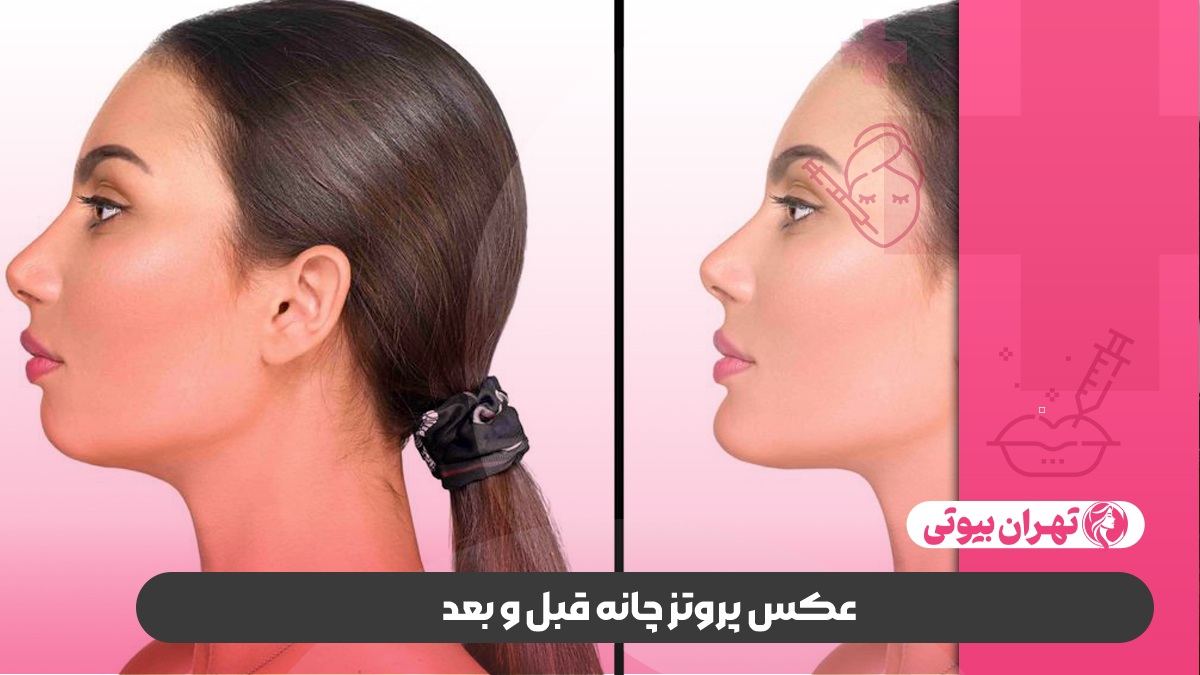 10 بهترین جراح پروتز چانه در تهران