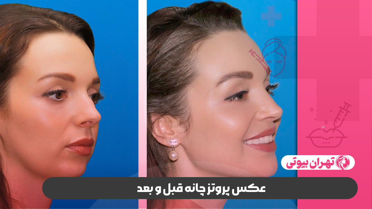 10 بهترین جراح پروتز چانه در تهران