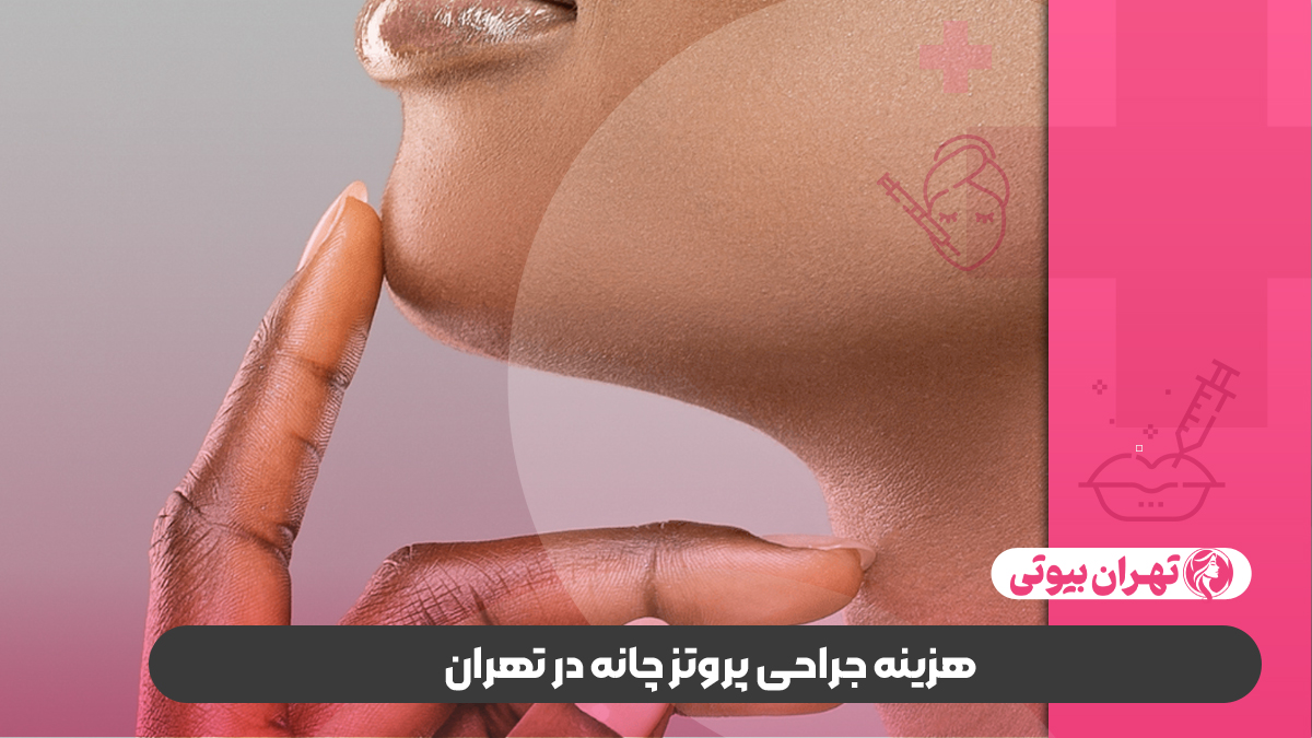 10 بهترین جراح پروتز چانه در تهران