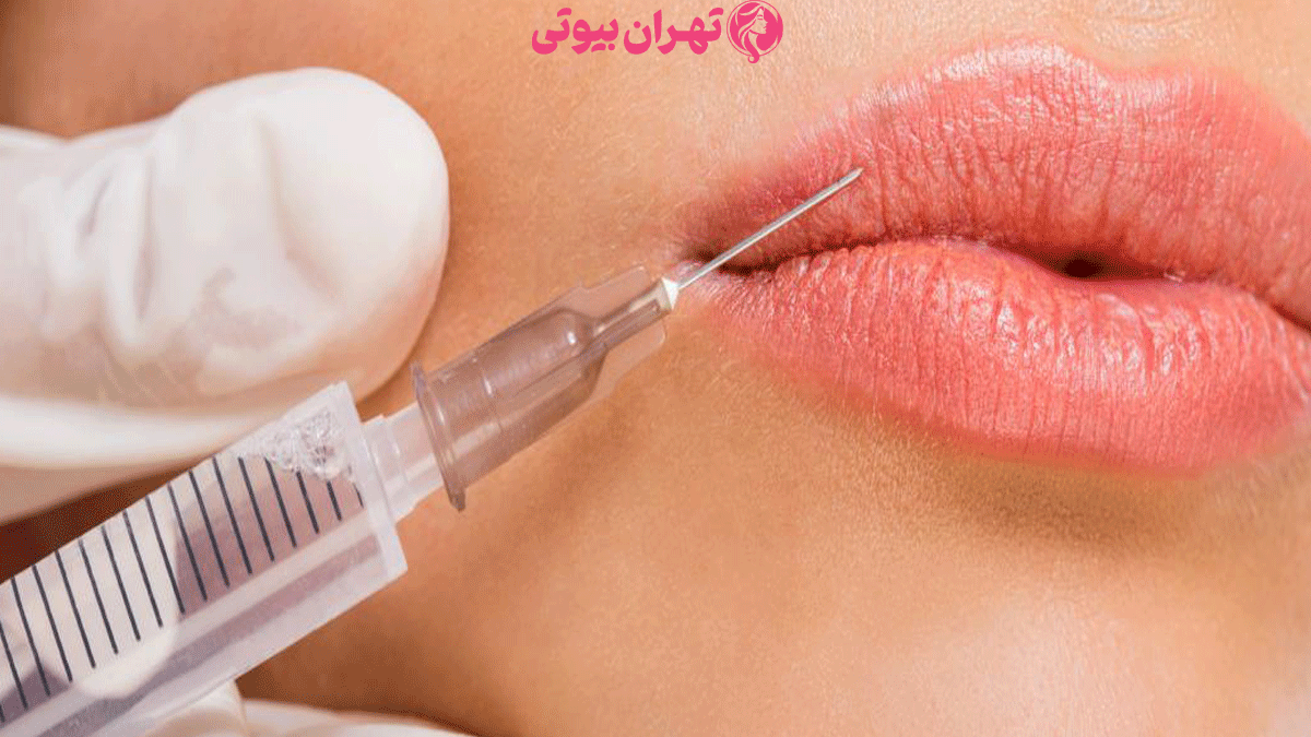 بهترین دکتر تزریق فیلر در تهران