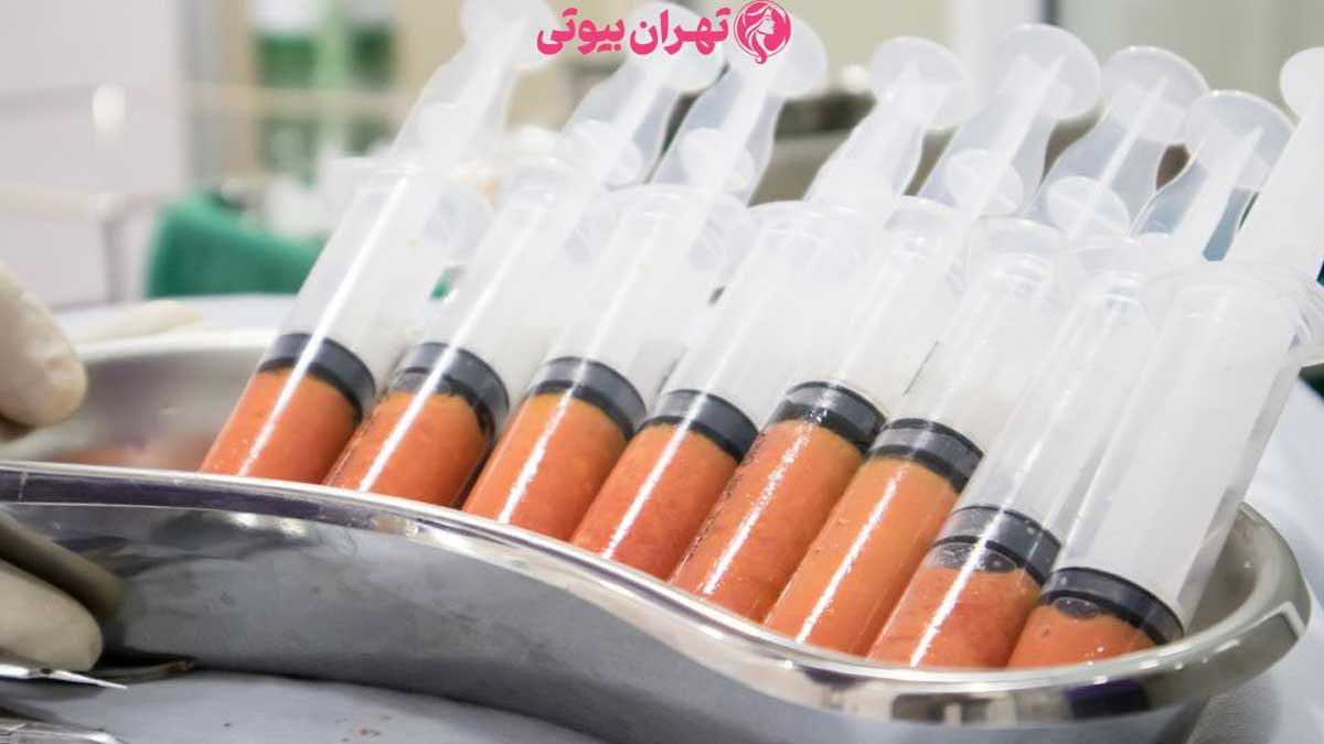 10 بهترین دکتر تزریق چربی در تهران