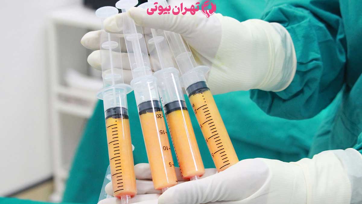 10 بهترین دکتر تزریق چربی در تهران
