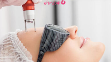 10 بهترین دکتر لیزر فرکشنال در تهران