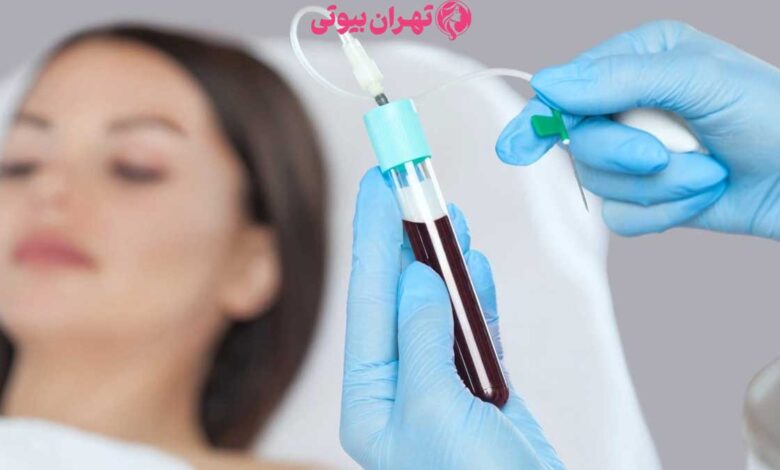 10 بهترین مرکز پی آر پی مو در تهران