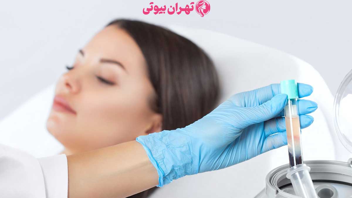 10 بهترین مرکز پی آر پی مو در تهران