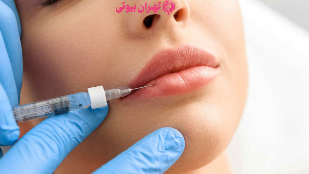 10 بهترین دکتر تزریق ژل در تهران