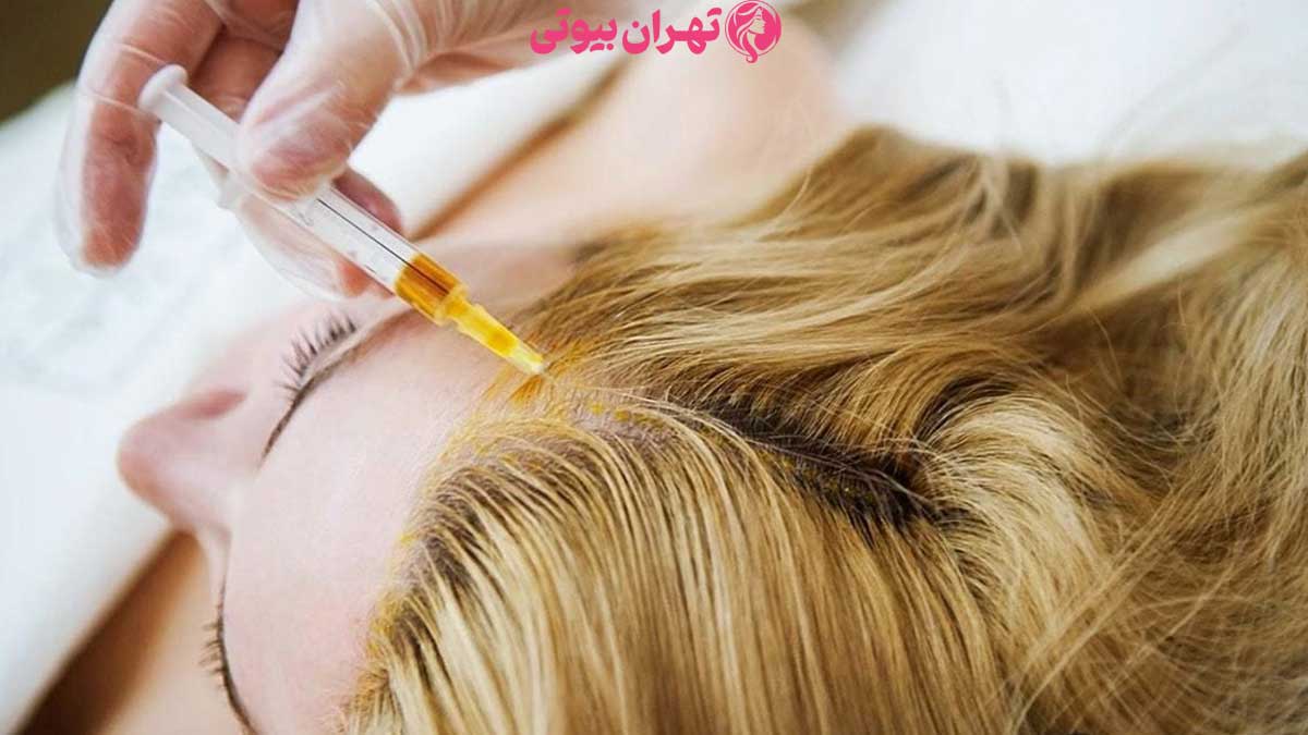 10 بهترین دکتر مزوتراپی مو در تهران