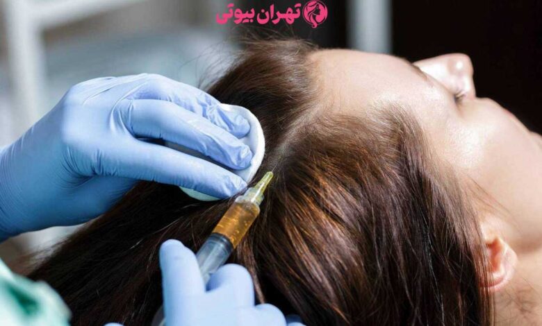10 بهترین دکتر مزوتراپی مو در تهران