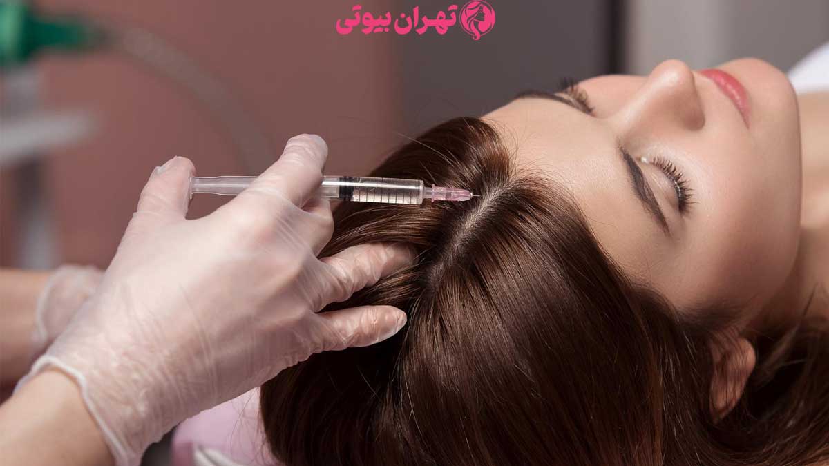 10 بهترین دکتر مزوتراپی مو در تهران