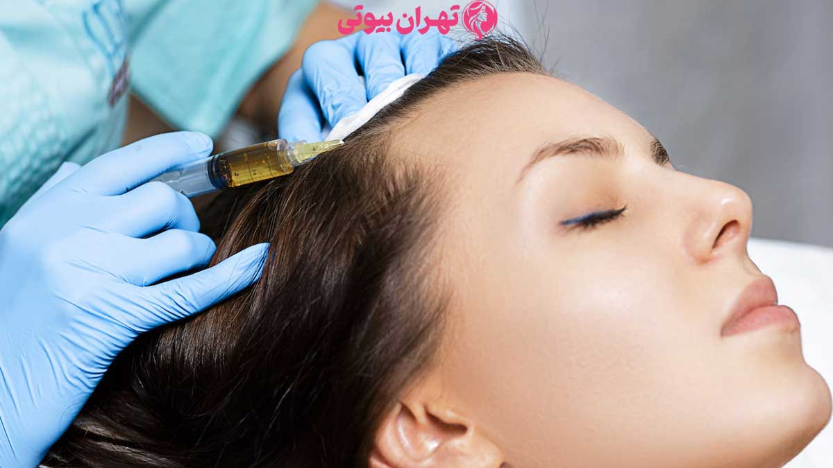 10 بهترین دکتر مزوتراپی مو در تهران