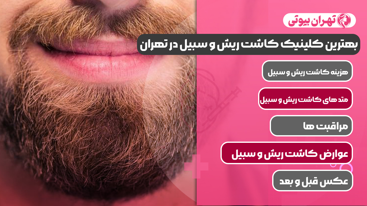 10 بهترین کلینیک کاشت ریش و سبیل در تهران
