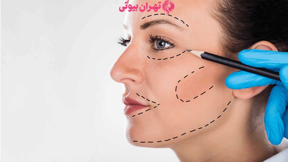10 بهترین دکتر عمل بوکال فت در تهران