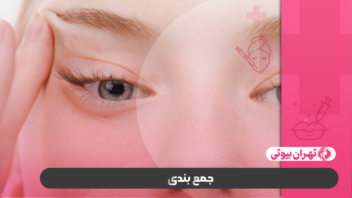 10 بهترین دکتر تزریق بوتاکس چشم گربه ای در تهران
