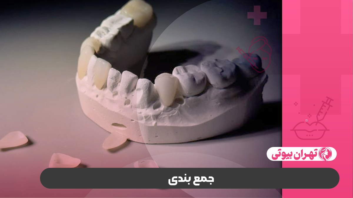 10 بهترین دکتر کامپوزیت دندان در تهران