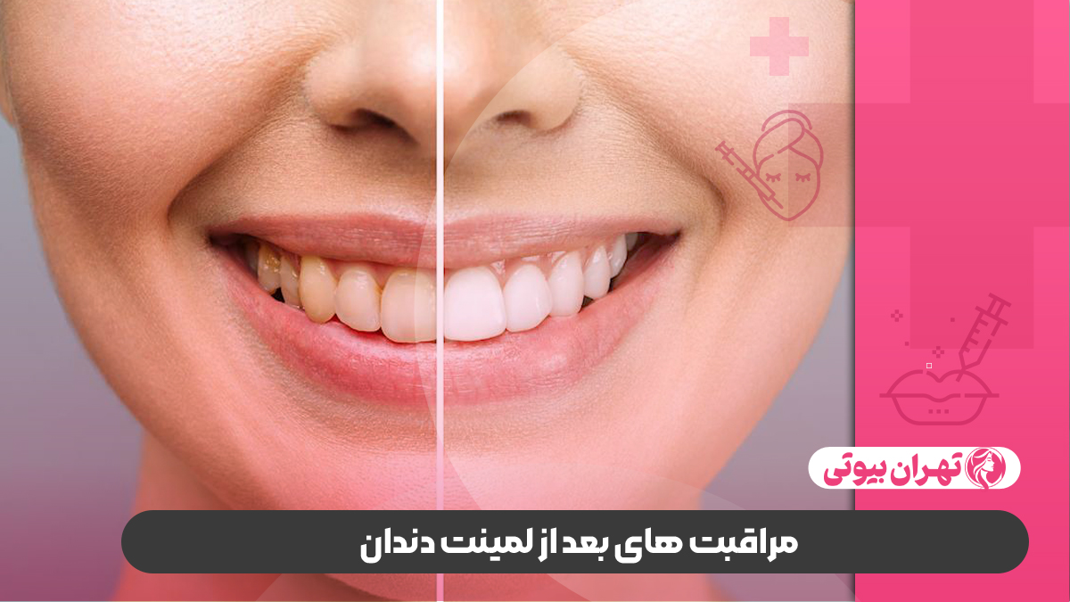 10 بهترین دکتر لمینت دندان در تهران