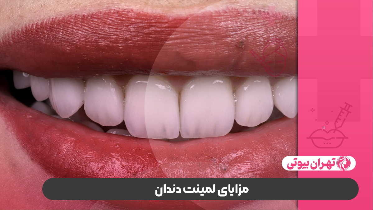 10 بهترین دکتر لمینت دندان در تهران