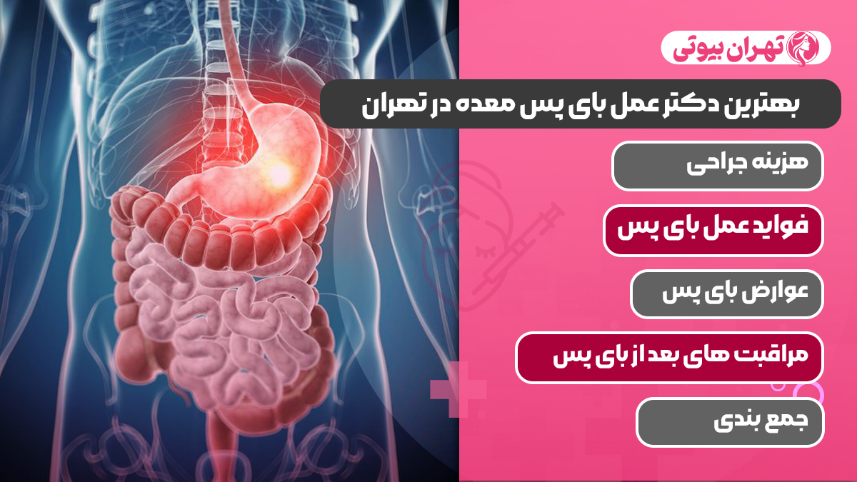 10 بهترین دکتر عمل بای پس معده در تهران