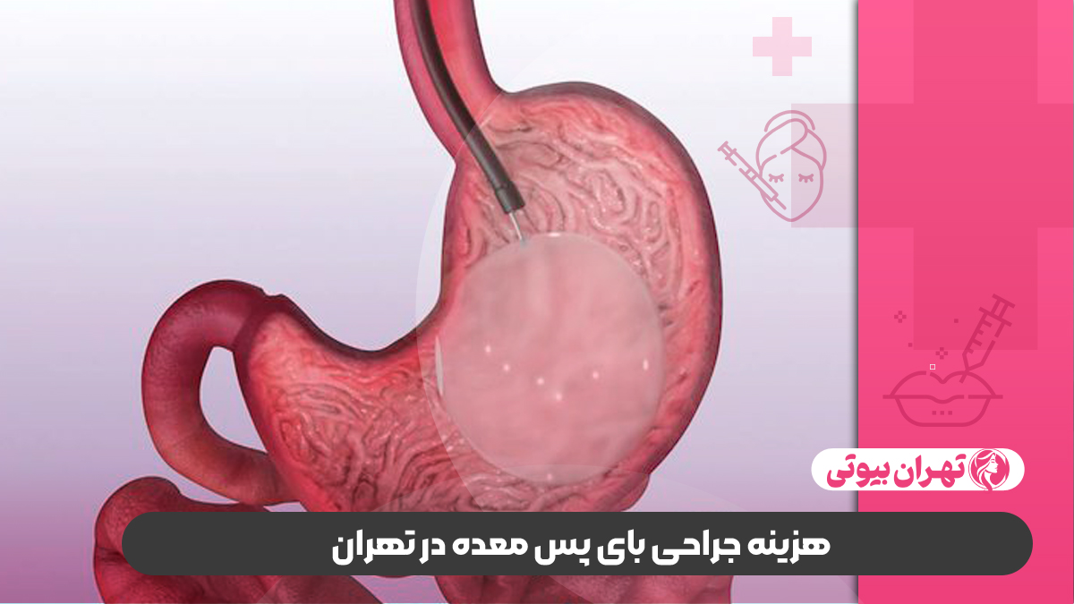 10 بهترین دکتر عمل بای پس معده در تهران
