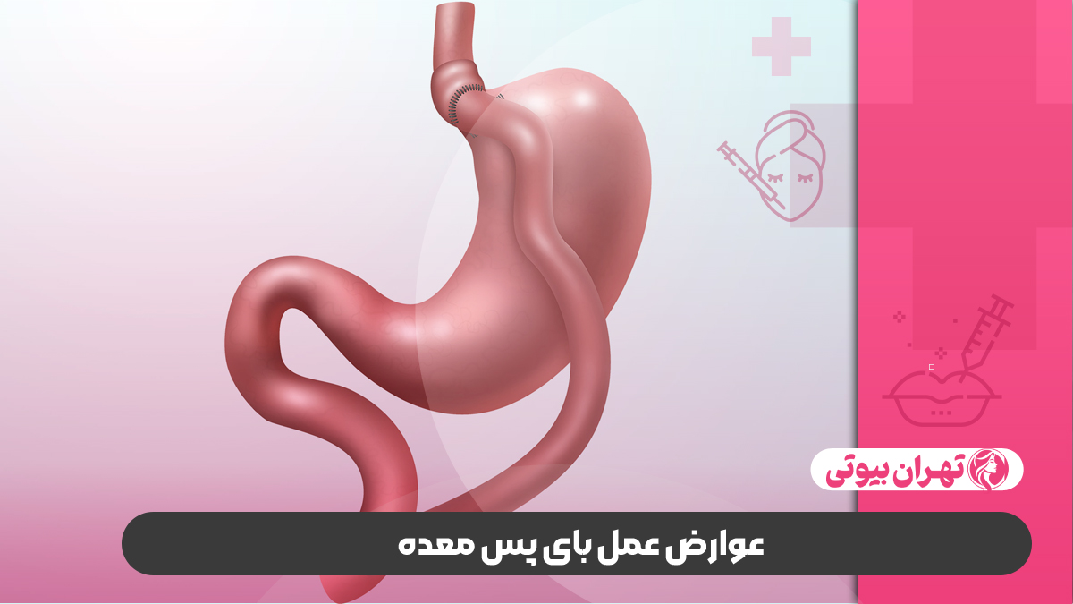 10 بهترین دکتر عمل بای پس معده در تهران