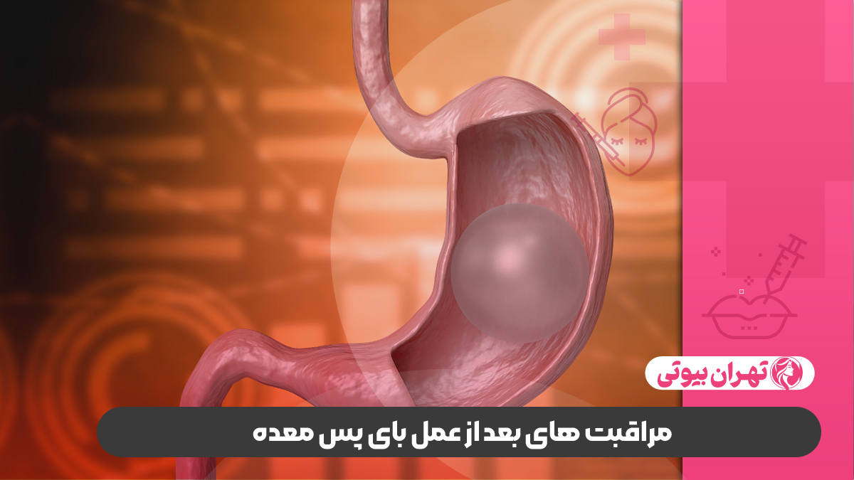 10 بهترین دکتر عمل بای پس معده در تهران
