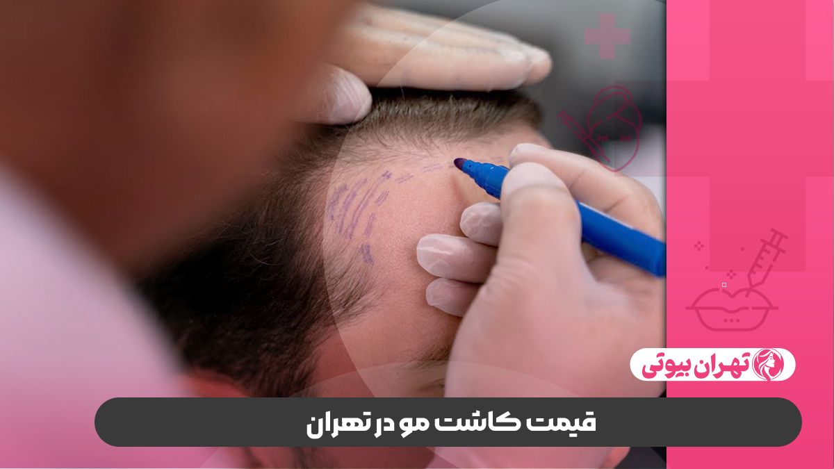 10 بهترین کلینیک کاشت مو در تهران