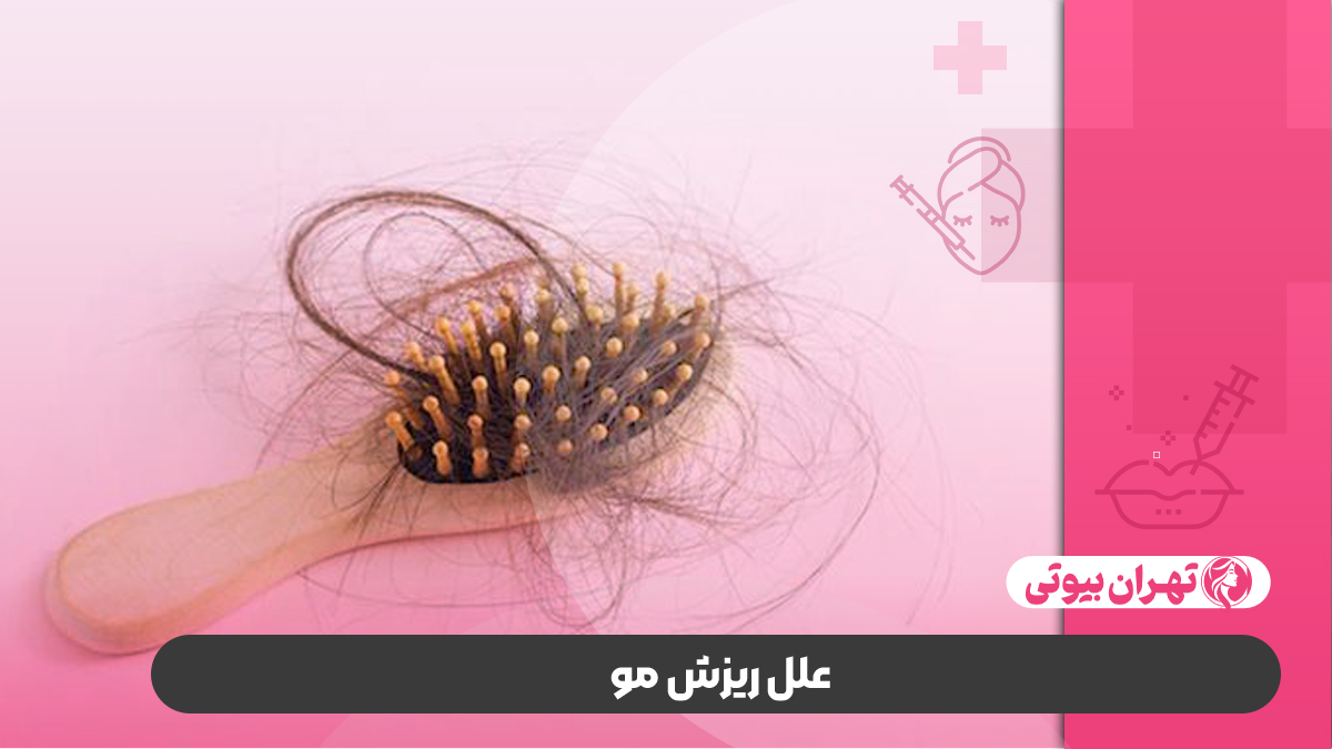 10 بهترین دکتر درمان ریزش مو در تهران